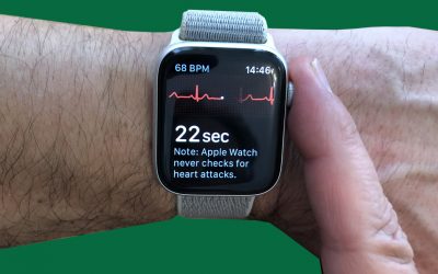 ECG on the Apple Watch